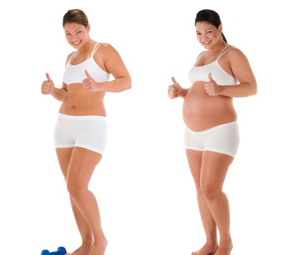 Pregnancy After Bariatric Surgery