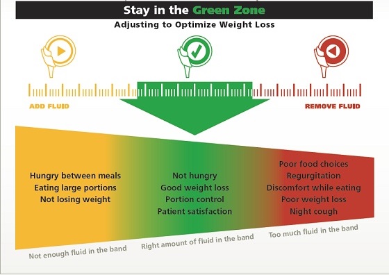 lap-band chart